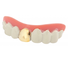  Dekoratiivsed hambad kullaga