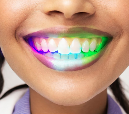 Dekoratiivne LED-hambaplaat